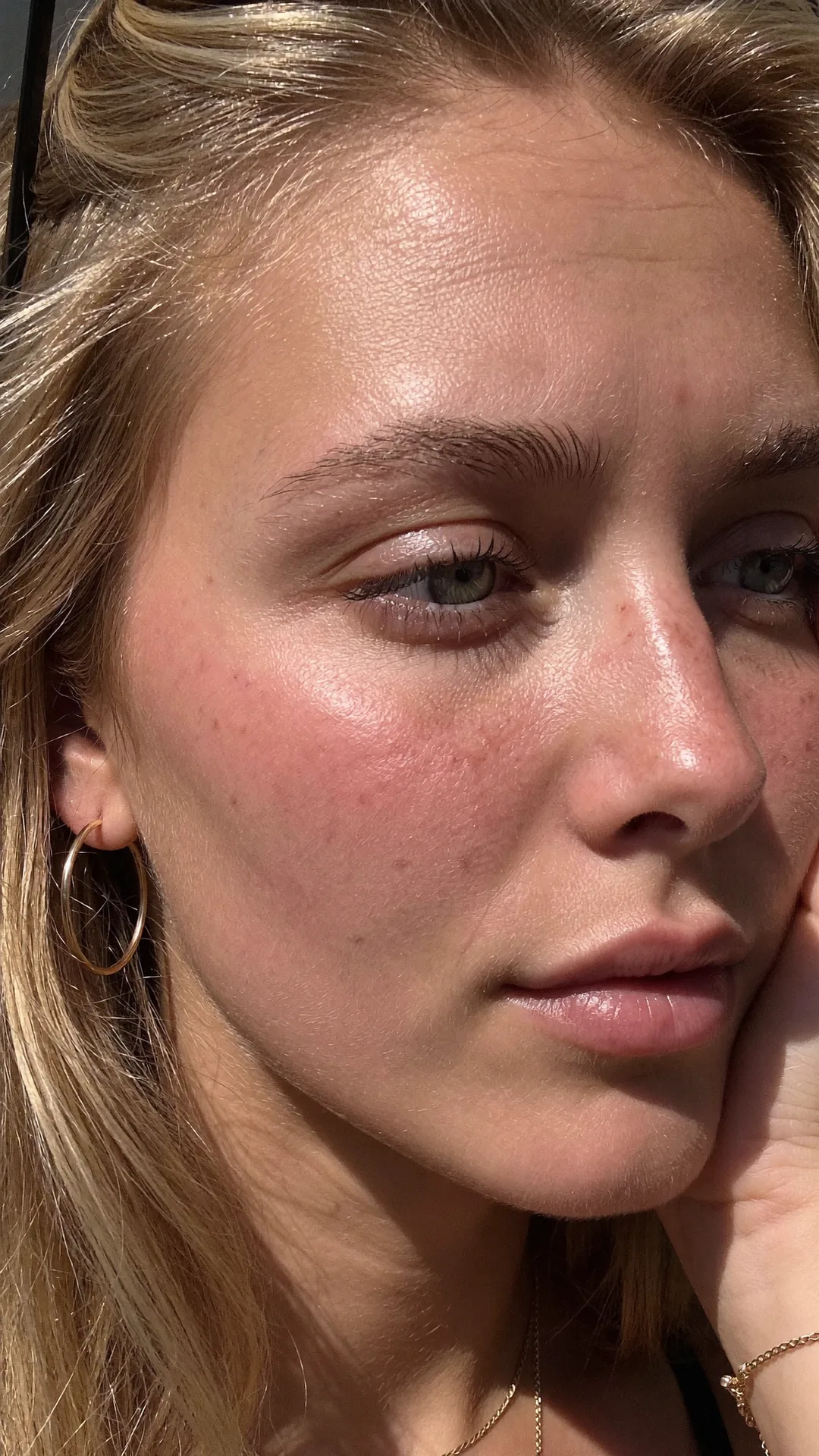 Manon, macro sur la joue : sébum, taches de rousseur